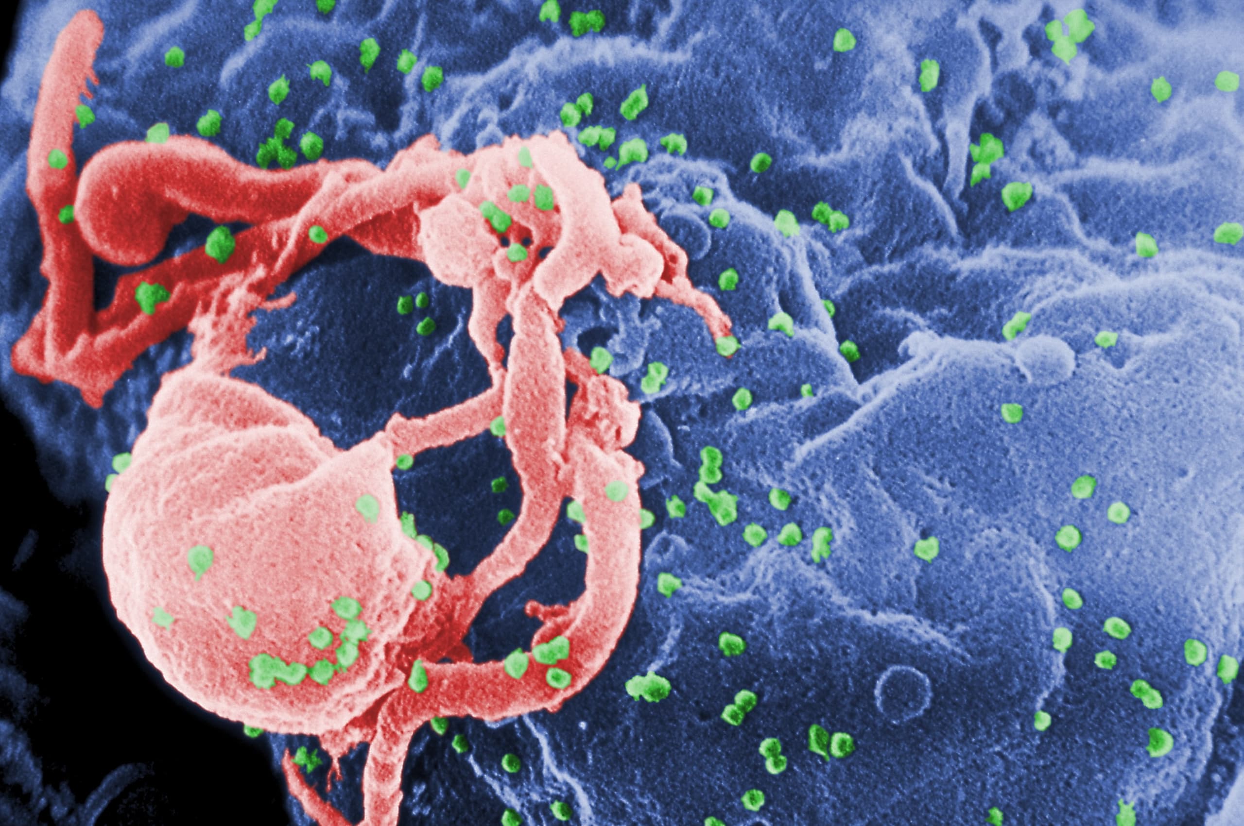 A three-dimensional molecular model of the HIV virus, showing a roughly spherical structure with surface proteins protruding from a lipid envelope, rendered in blue, purple, and red against a neutral background.